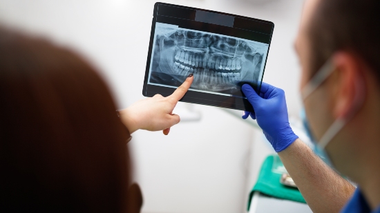 Dentist Highlights an X-ray Demonstrating the Importance of Dental Radiographs in Santa Barbara, CA